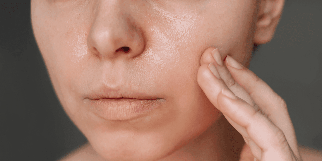 Comprendre la peau grasse - Beseed