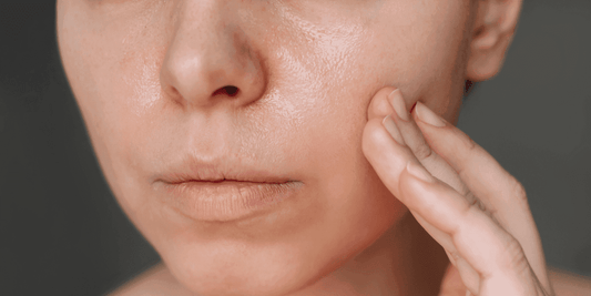 Comprendre la peau grasse - Beseed