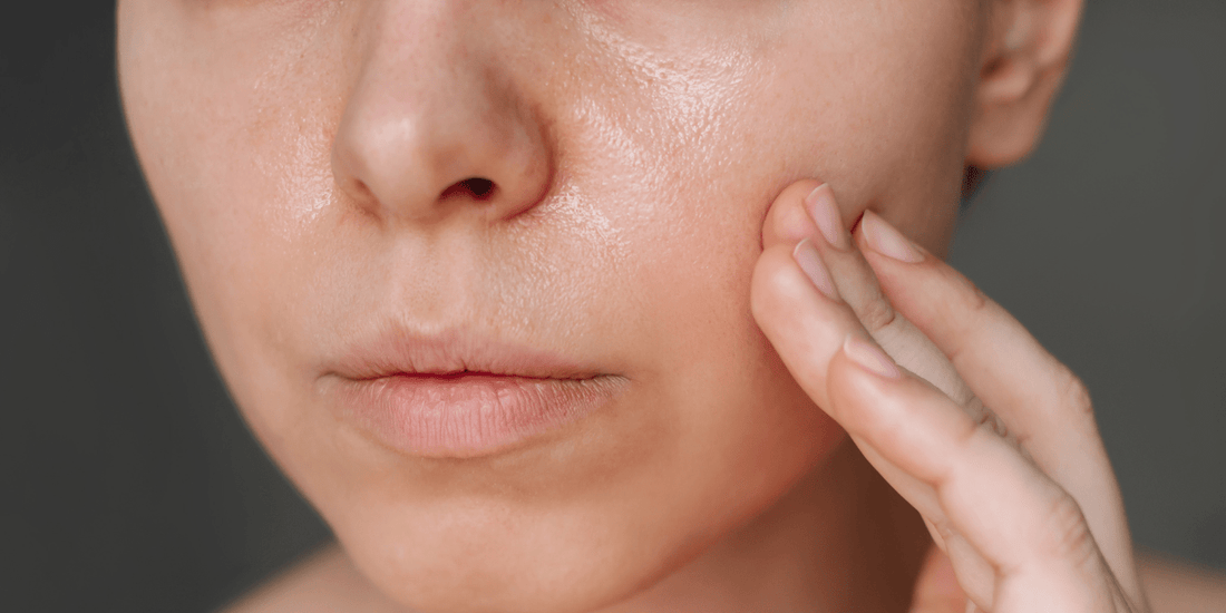 Qu'est ce qui rend ma peau grasse ? - Beseed